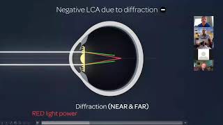 Premium IOLs: Where Are We in Post Refractive Cataracts