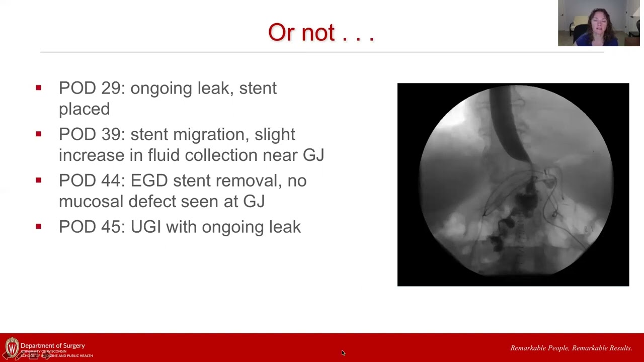 Flexible Endoscopy: Endoscopic Identification of Leaks to Permit Endoscopic Therapy