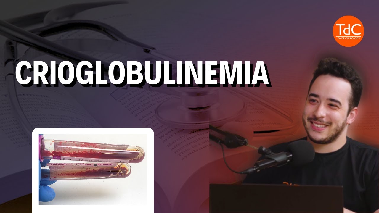Thumbnail - Crioglobulinemia