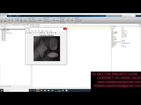 Image Segmentation for Intensity Inhomogeneity in Presence of High Noise Matlab