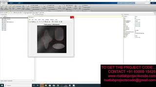 Image Segmentation for Intensity Inhomogeneity in Presence of High Noise Matlab