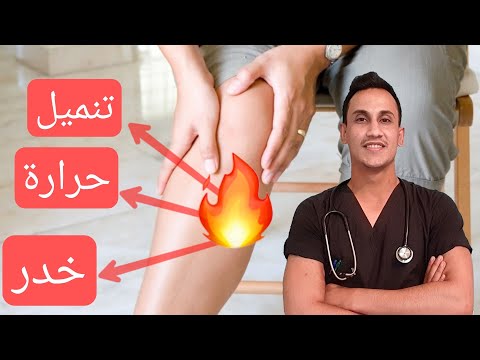 متلازمة الساق المتململة | #التشخيص | #العلاج  | RLS syndrome