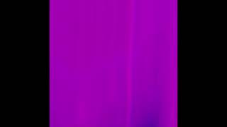 Gotzzy - Skrt Official Audio