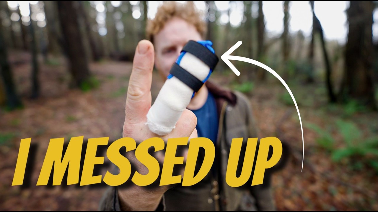 ⁣I Nearly Lost My Finger | Some Good News, Some Bad