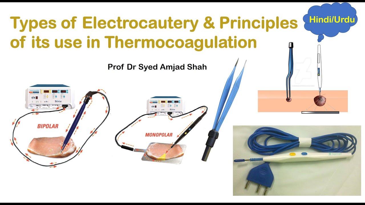 Types of Electrocautery & Principles of its use in