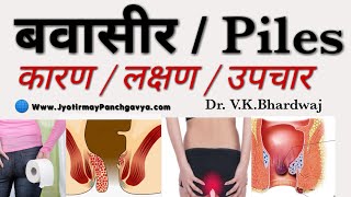 बवासीर Piles Hemorrhoids क्यों होता हैं.? Complete Panchgavya Treatment For Piles , Part - I