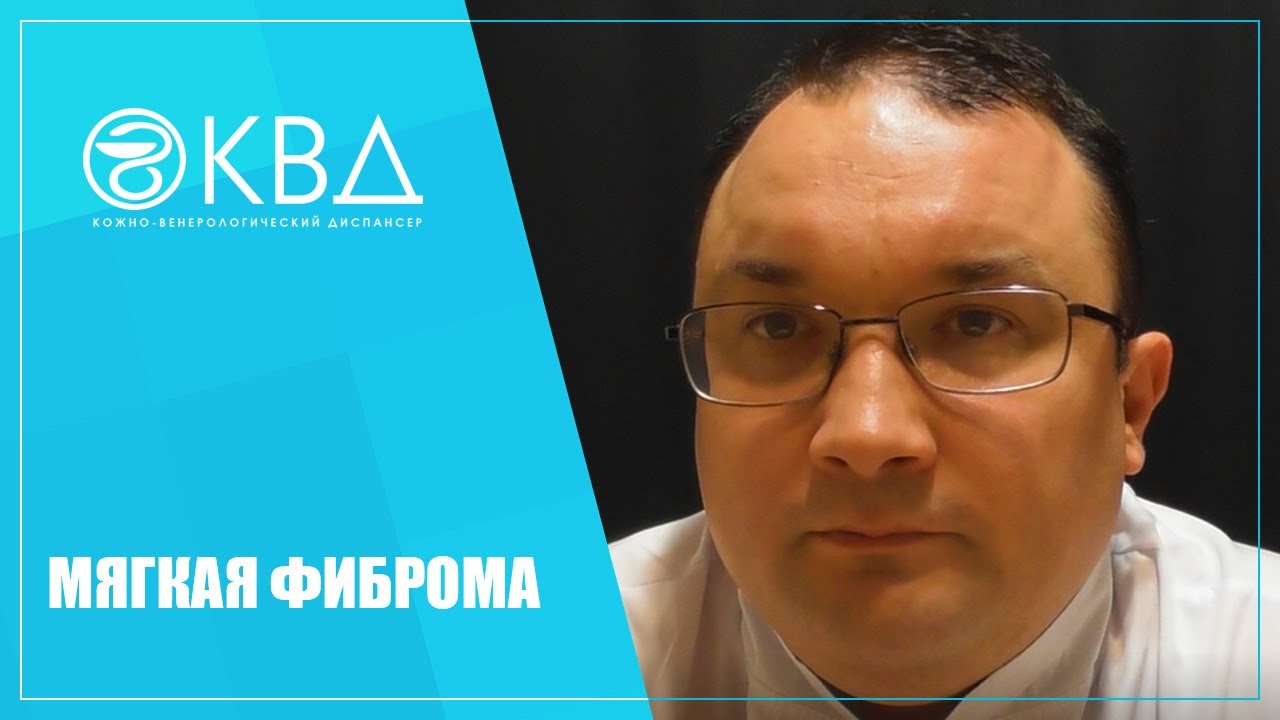 1332 Мягкая фиброма