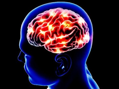 Možganska kap XIV vratne arterije 2021