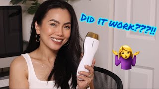 2 MONTHS UPDATE USING PINKZIO HOME IPL HAIR REMOVAL DEVICE | IT WORKED screenshot 4
