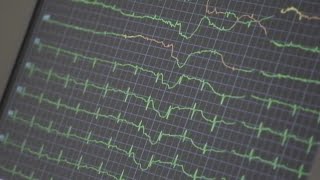 Doctors talk COVID-19 and the heart during American Heart Month