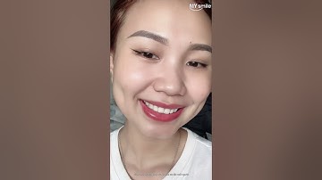 Nụ cười tỏa sáng cùng Mysmile