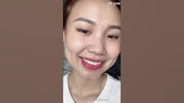 Nụ cười tỏa sáng cùng Mysmile