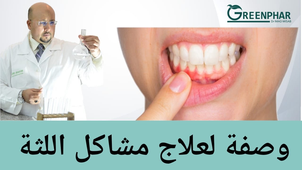 وصفة طبيعية لعلاج مشاكل اللثة مع الدكتور عماد ميزاب Dr Imad Misab