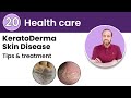 ### Title: "Unveiling Keratoderma: Understanding and Managing Thickened Skin Disorders"###
