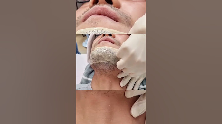 Beard Hair Pulling Hair Waxing Stress Relief Pleasure Skin Beauty Skin Care Men 수염왁싱 털뽑기 #shorts