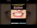 Stresul Cronic