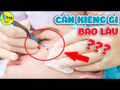Video Tẩy nốt ruồi cần kiêng nước bao nhiêu, nên làm gì để... - youtube