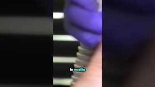 Can the right shoes help with stress fractures This customer shares her experience Can the right shoes help with stress fractures This customer shares her experience