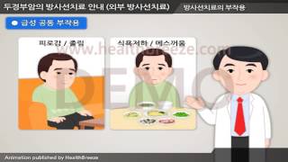 [시연용] c0228aako 두경부암의 방사선치료 안내