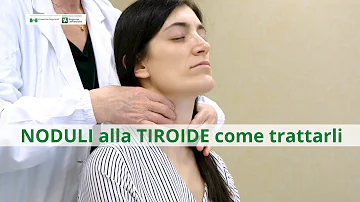 Come si cura nodulo alla tiroide?