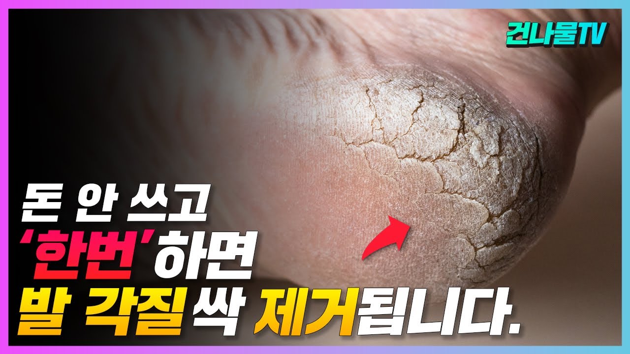 발 각질 제거 돈 쓰지 말고 이것! 한번으로 매끈하게 싹 사라집니다