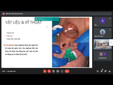 Video PHTL3 - Lấy dấu và đổ mẫu hàm toàn bộ (19/10) - youtube