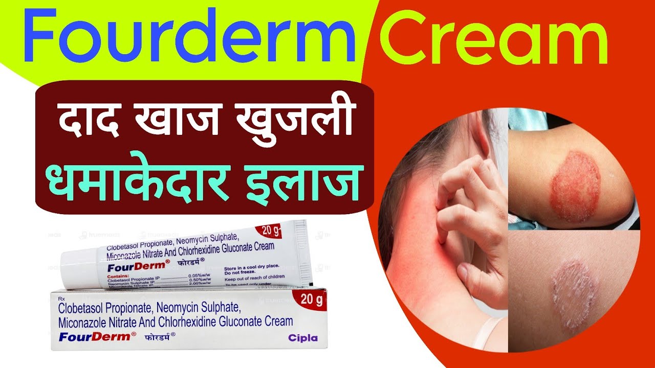 Fourderm Cream क्या है? | Skin Infection Treatment | Fungal & Bacterial Relief | Safe Usage Tips