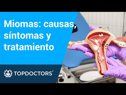 Miomas: causas, síntomas