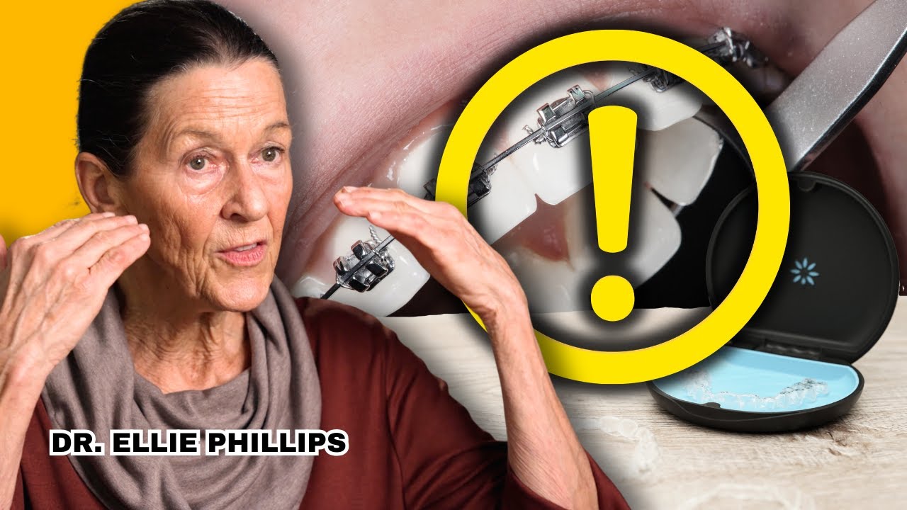 Watch Out for THIS with Invisalign and Braces