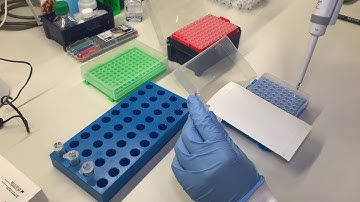 Detection of COVID-19 by qPCR