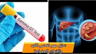 تحليل غاما غلوتاميل للاطمئنان على صحة الكبد و القنوات الصفراوية ،مهم لمدمني الكحول! Gamma GT TEST