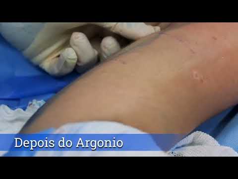 ArgoPlasma - Dr. Moises De Melo