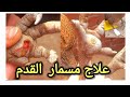مسمار القدم عند الطيور أسبابه وطرق الوقاية وعلاجه بسهولة وبدون أي تكاليف 