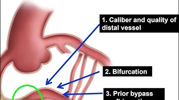 CTO PCI: performing and analyzing the angiogram