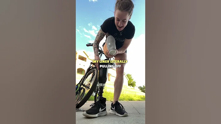 My prosthetic is falling off! 😳