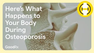 Here’s What Happens to Your Body During Osteoporosis | GoodRx