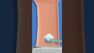 ASMR | How Leg Bone Surgery Is Done 💉🦵 #shorts