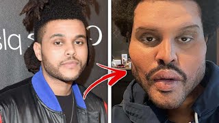Unrecognizable Celebrities Who Had TOO Much Plastic Surgery