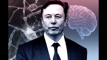 ELON MUSK NEURALINK KOMPANIYASINING 3 MUVOFFAQIYATI