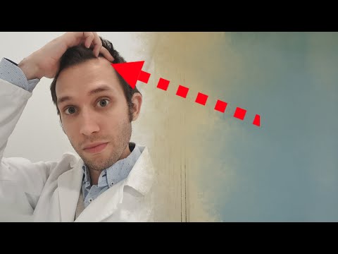Video: ¿Cuándo empiezan a retroceder las líneas del cabello?