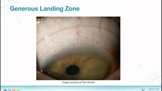 Zen Scleral Lens screenshot 4