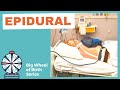 EPIDURAL FOR LABOR PAIN