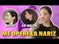 ME OPERÉ LA NARIZ Y LES GRABÉ TODO!*no lo van a creer* (experiencia con la rinoplastia dia con dia)