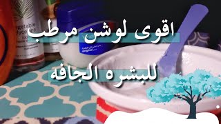 DIY اقوى خلطة ترطيب للبشرة الجافة جدا بمكونات رخيصه