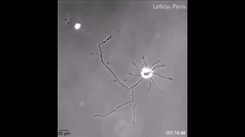 A lone brain cell reaching out for connections
