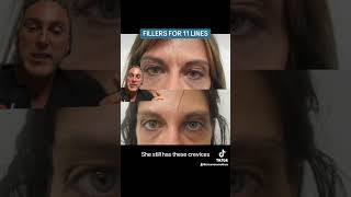 Fillers for 11 Lines