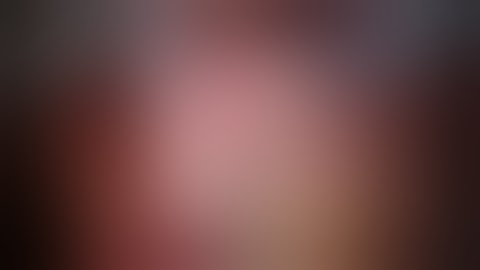 Robotic Intersphinteric Resection with Lateral Pelvic Lymph Node Dissection for Distal Rectal Cancer