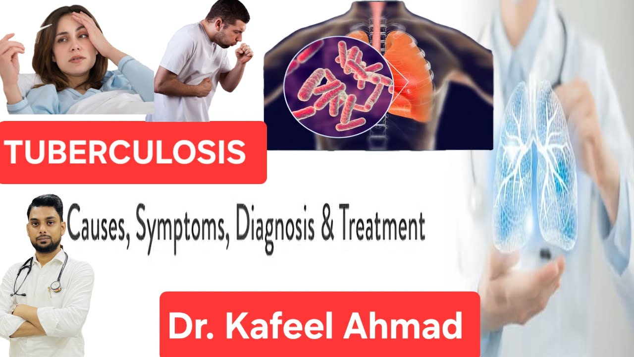 TB Disease Full Guide | Signs, Spread & Complete Treatment
