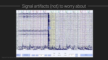 Signal artifacts (not) to worry about