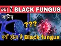 क्या है Black fungus ?? | क्यों होता है Black fungus ? | what is black fungus | kya he black fungus